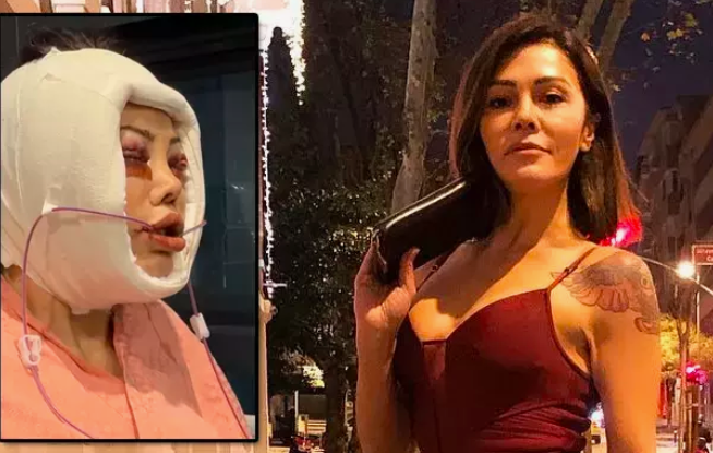 Didem Ceran hangi ameliyatları geçirdi?