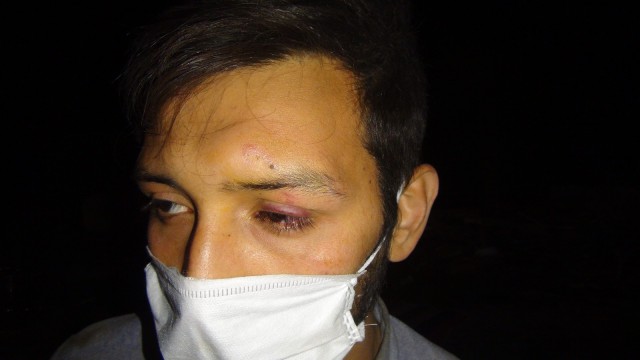 Hırsızlar görevliyi hortumla döverek bayılttı