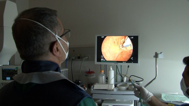 (ÖZEL) Başakşehir Şehir Hastanesinde ilk kez 3 yaşındaki çocuğa “ERCP” tedavisiyle uygulandı