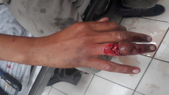 Parmağı yüzüğüne sıkışan şahsı itfaiye kurtardı