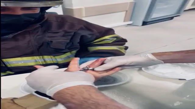 Parmağına sıkışan yüzüğü itfaiye ekipleri keserek çıkarttı