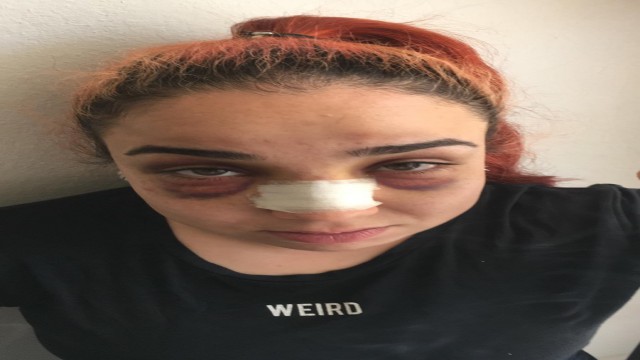 Telefonla konuştuğu için çalışanını darp etti