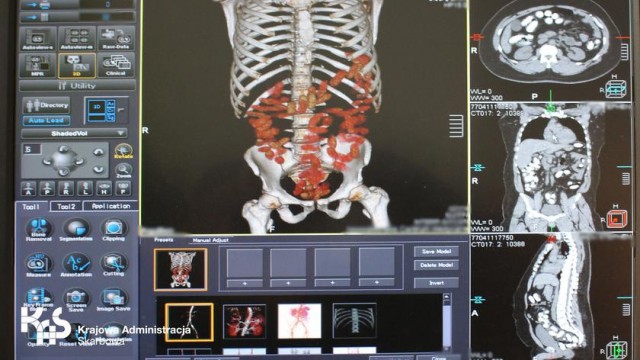 Varşovada havaalanında yakalanan kaçakçının midesinden eroin çıktı