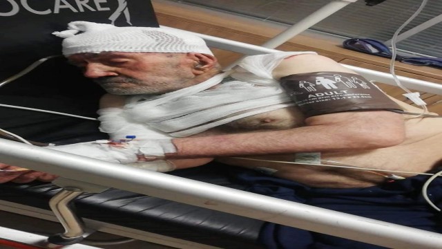 Yangında yaralanan yaşlı adam hayatını kaybetti