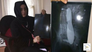 Kadın hastanın karnında mala unutuldu!