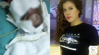 Sevdiği kadının yüzünü kimyasalla yaktı