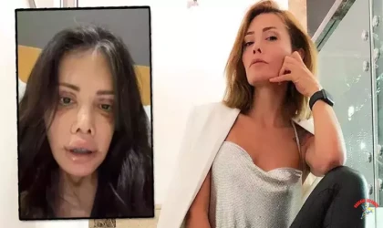 Didem Ceran'ın Yüz Nakli Sonrası Şaşırtan Paylaşımı: Kaşında Saç Çıktı!